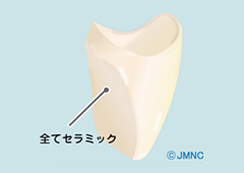 セラミッククラウン