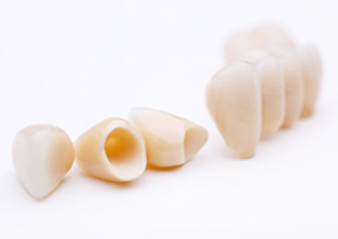 セラミック治療