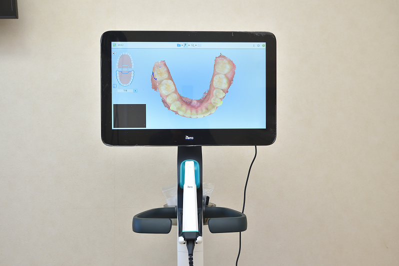 光学印象機器（iTero）（TRIOS）
